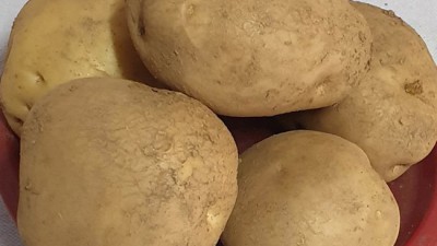 감자왕왕20kg 대용량의 행복! 솔직 후기와 꿀팁 대방출!🥔✨
